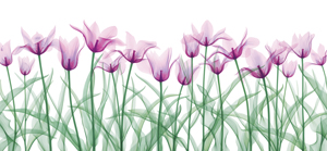 Tulip Row by Jim Wehtje